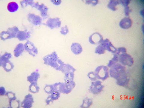 Image of Bartonella