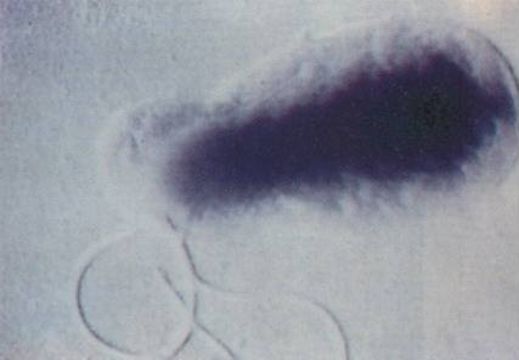Image of Bartonella