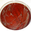 Imagem de Mycolicibacterium smegmatis