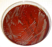Image of Mycolicibacterium smegmatis