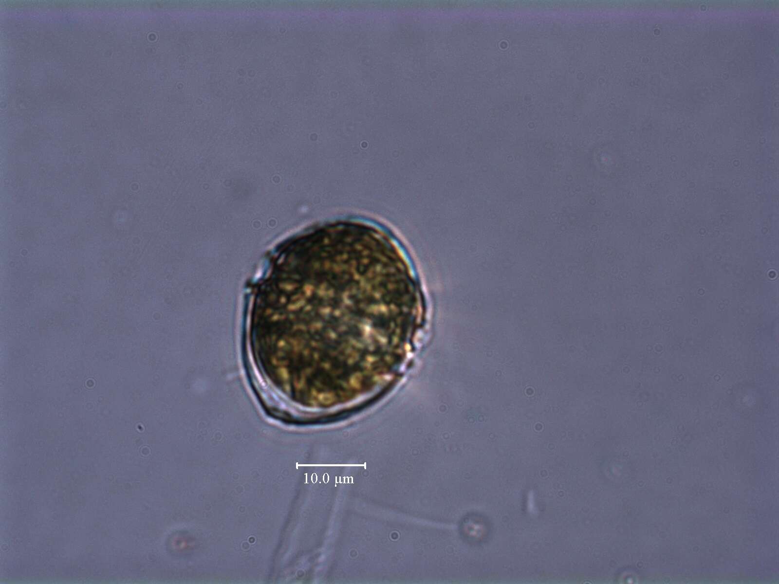 صورة Chimonodinium lomnickii