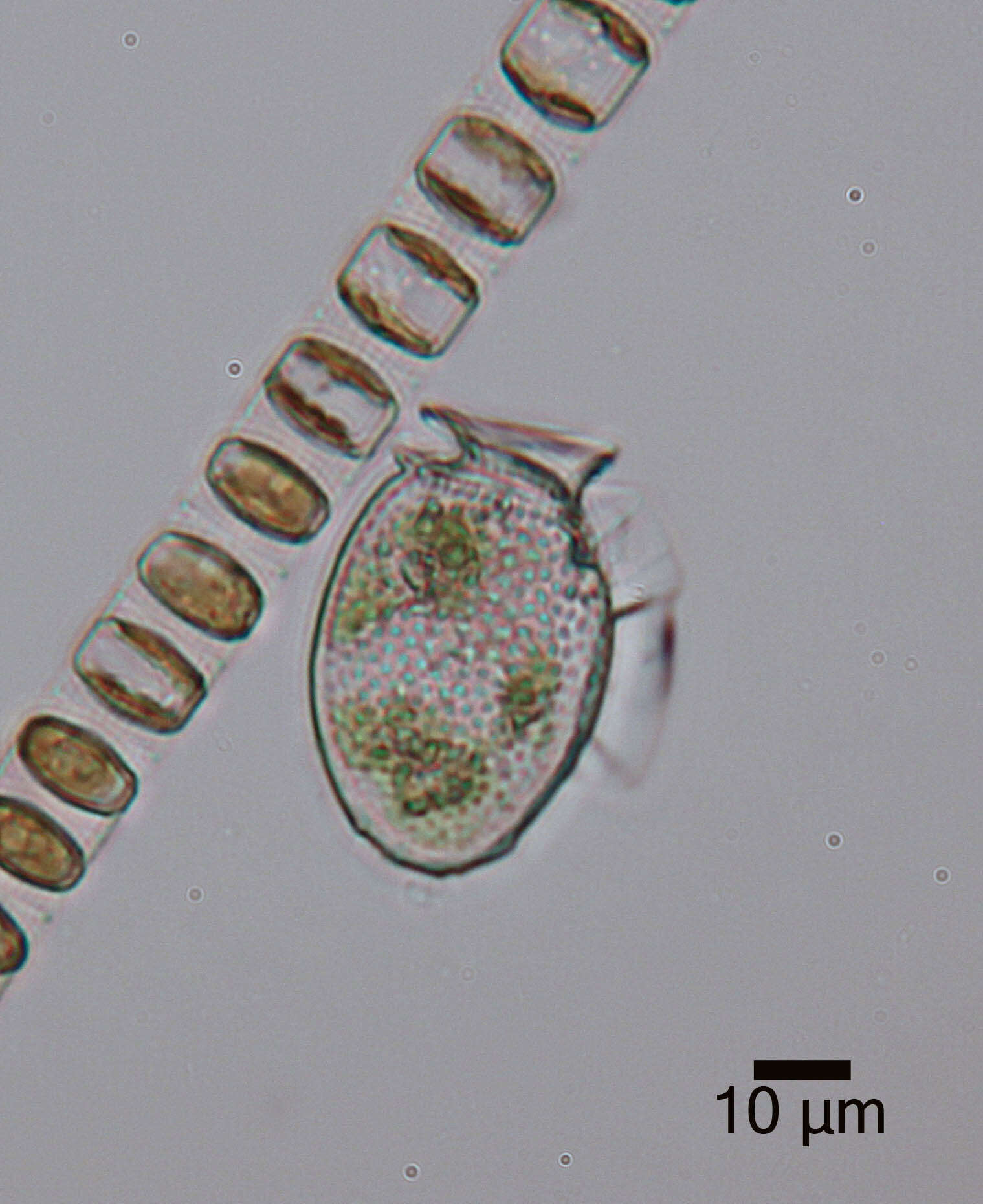 صورة Dinophysis acuminata