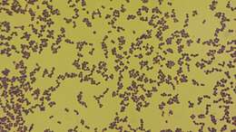 Image of Aerococcus urinae