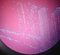 Image of Aerococcus