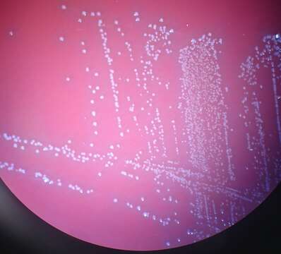 Sivun Aerococcus kuva