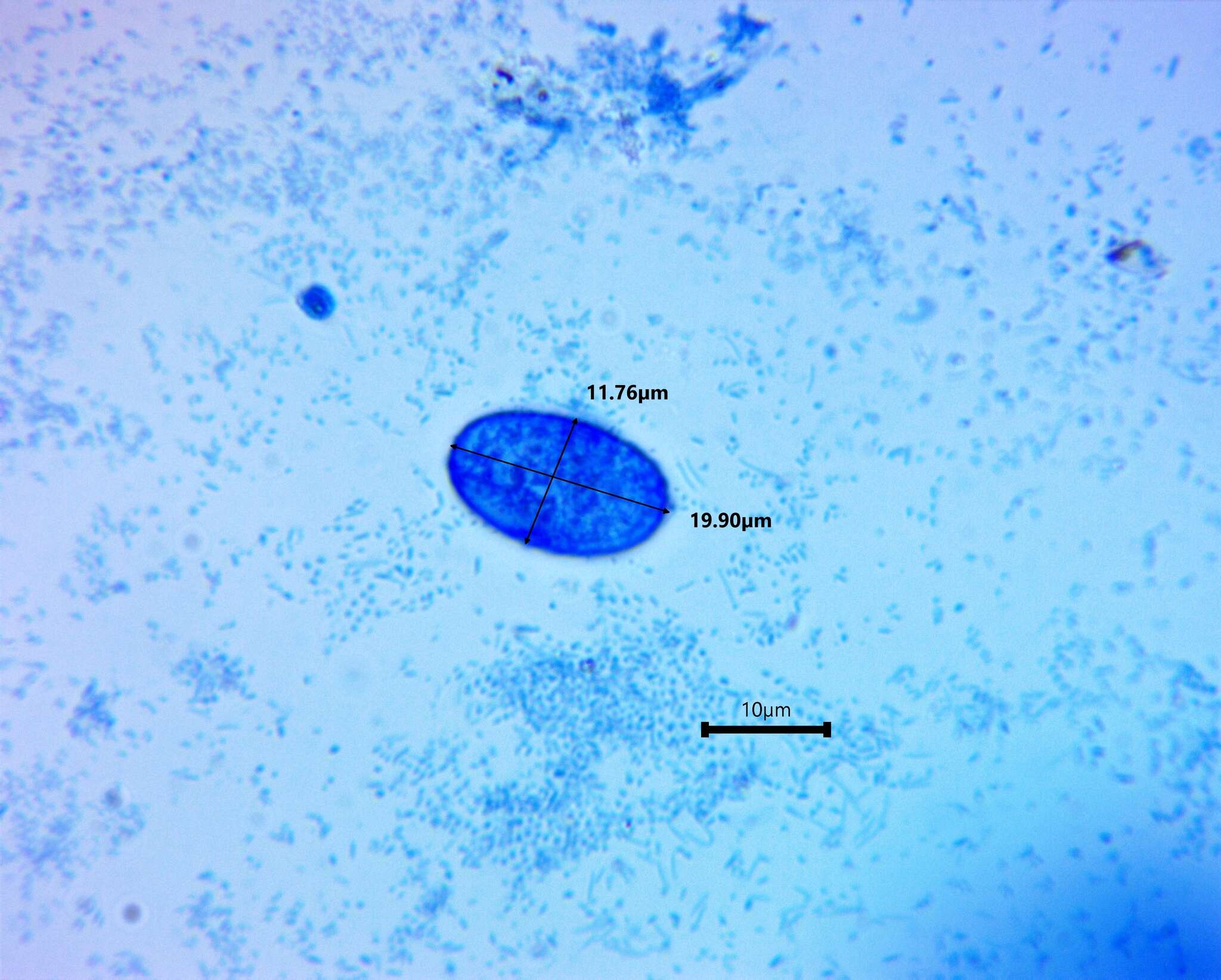 Image of Scutellinia olivascens (Cooke) Kuntze 1891