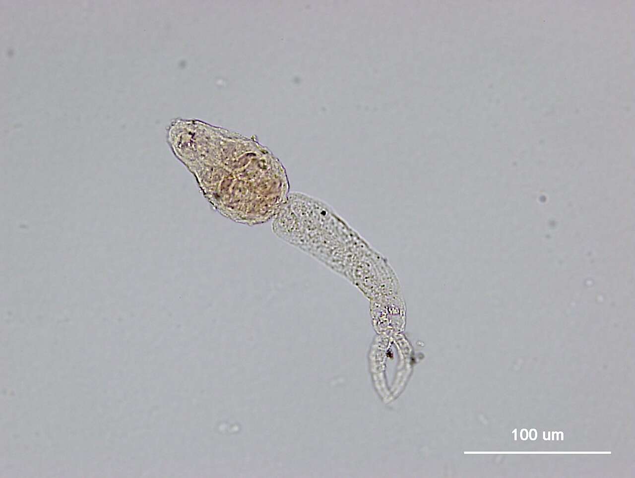Image of Schistosoma japonicum