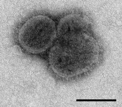 Plancia ëd Thogotovirus