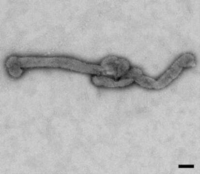 Image of Bourbon virus