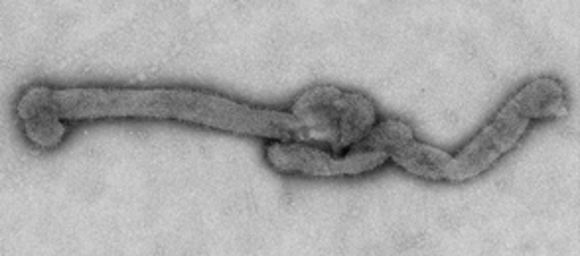 Image of Bourbon virus