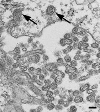 Image of Bourbon virus