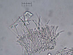 Image of Eupezizella aureliella (P. Karst.) T. Kosonen, Huhtinen & K. Hansen