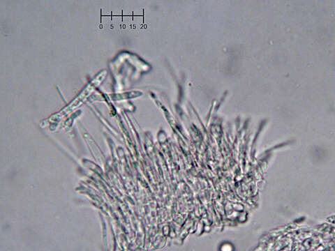 Image of Eupezizella aureliella (P. Karst.) T. Kosonen, Huhtinen & K. Hansen