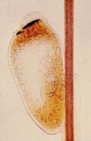 Pediculus humanus humanus Linnaeus 1758 resmi