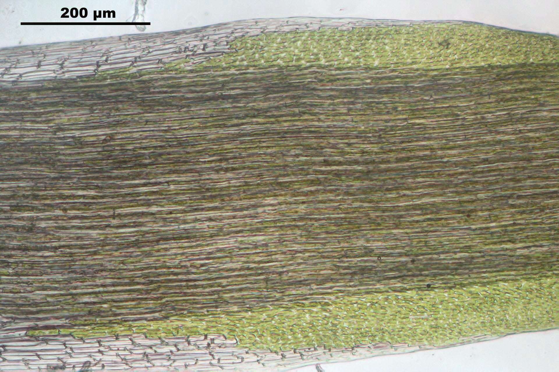 Image of campylopus moss