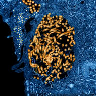 Image of Zaire ebolavirus