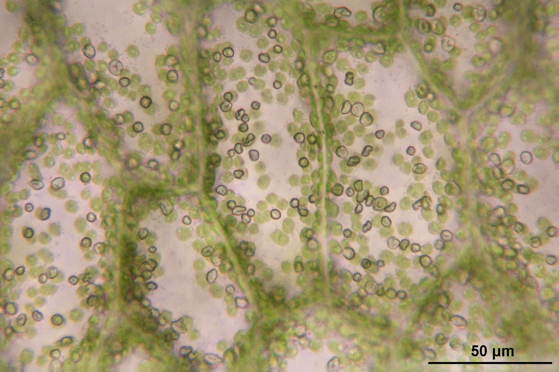 Image of overleaf pellia