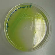 Слика од Pseudomonas aeruginosa