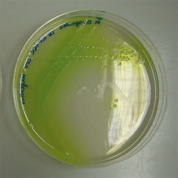 Слика од Pseudomonas aeruginosa