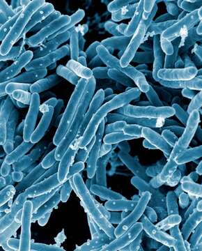 Image of 'Mycobacterium tuberculosis complex'