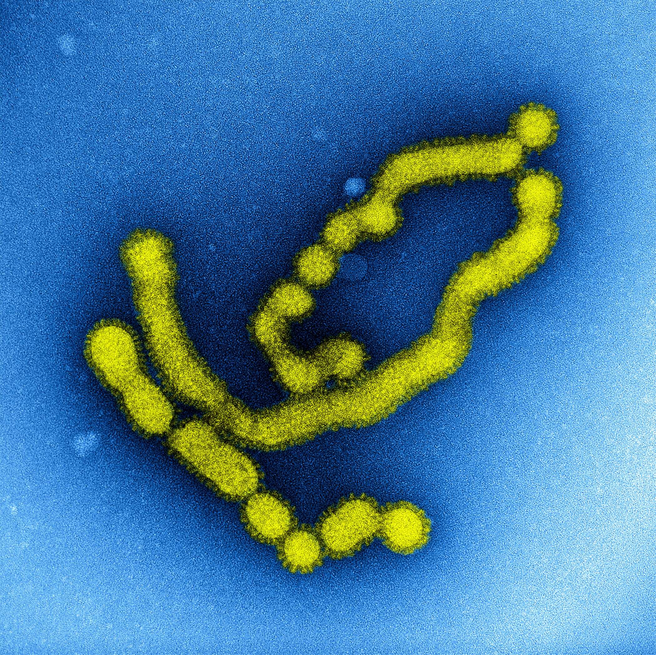 Image of Influenza A virus