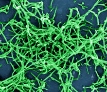 Image of Zaire ebolavirus