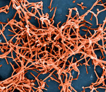 Image of Zaire ebolavirus