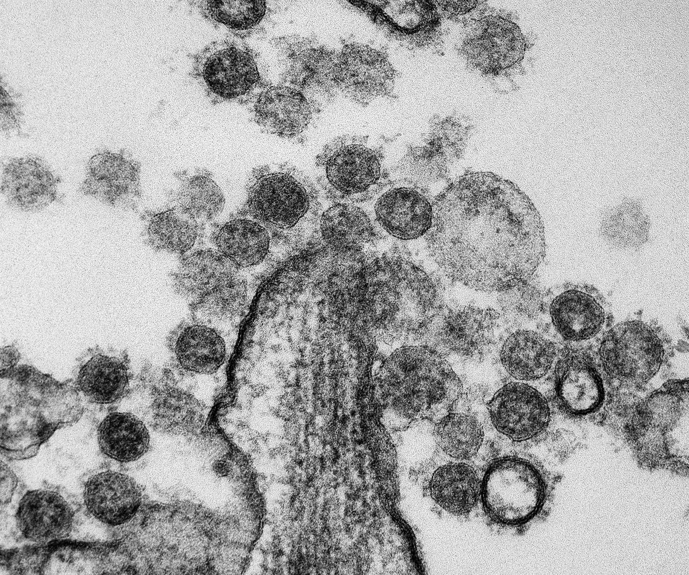 Image of Betacoronavirus