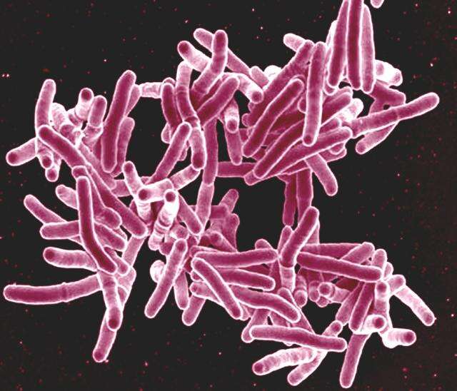 Sivun 'Mycobacterium tuberculosis complex' kuva