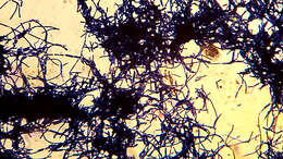 Image de Bacillus cereus