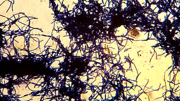 Imagem de Bacillus cereus