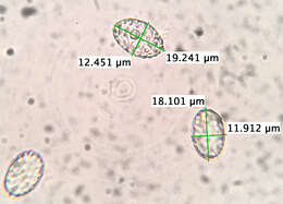 Image of Scutellinia vitreola Kullman 1982