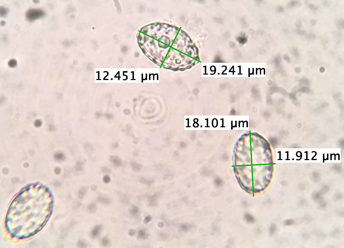 Image de Scutellinia vitreola Kullman 1982