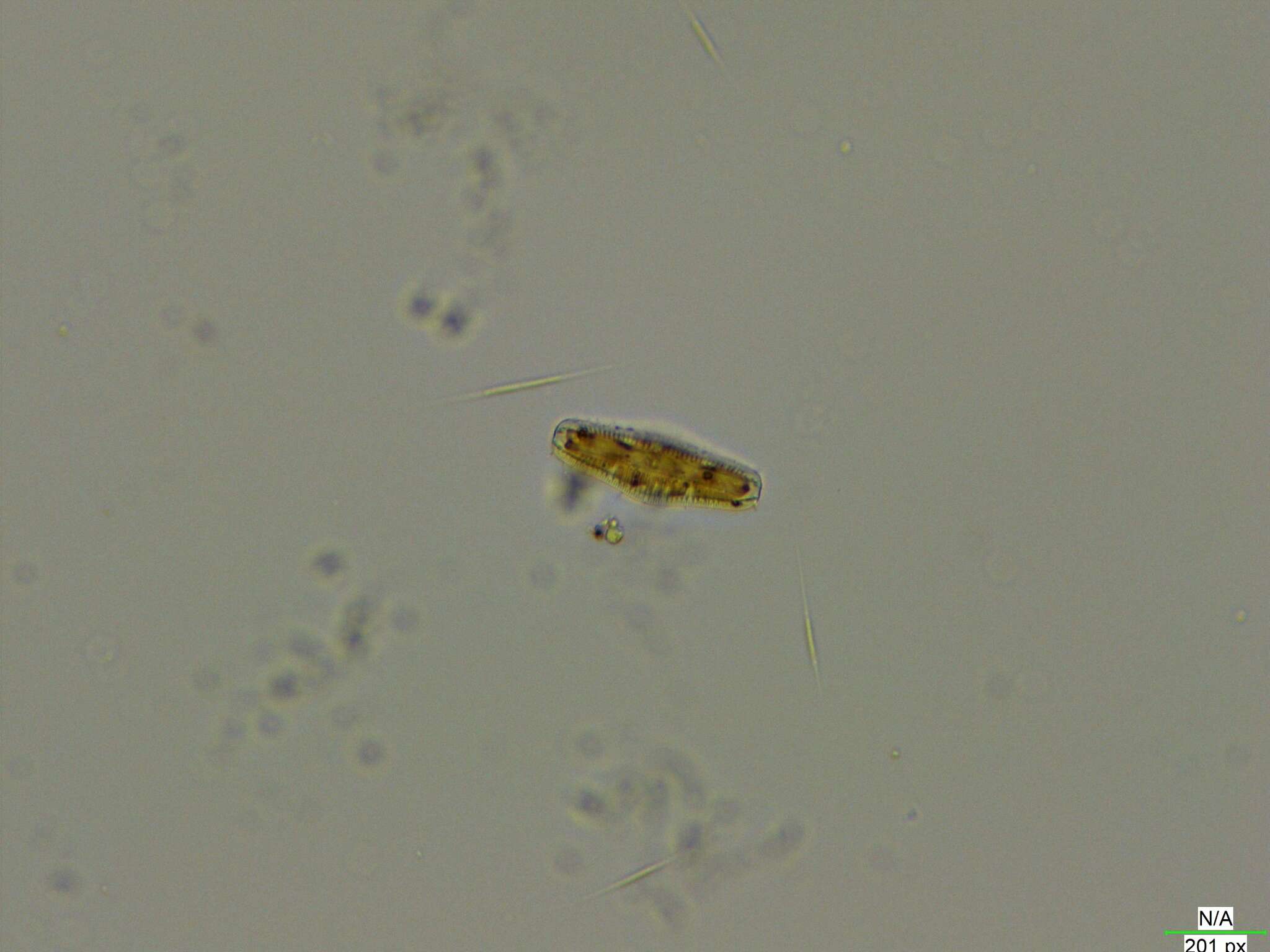 Image of <i>Epithemia gibba</i> Kützing