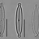 Image of Encyonopsis subminuta Krammer & E. Reichardt 1997