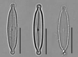 Image of Encyonopsis subminuta Krammer & E. Reichardt 1997