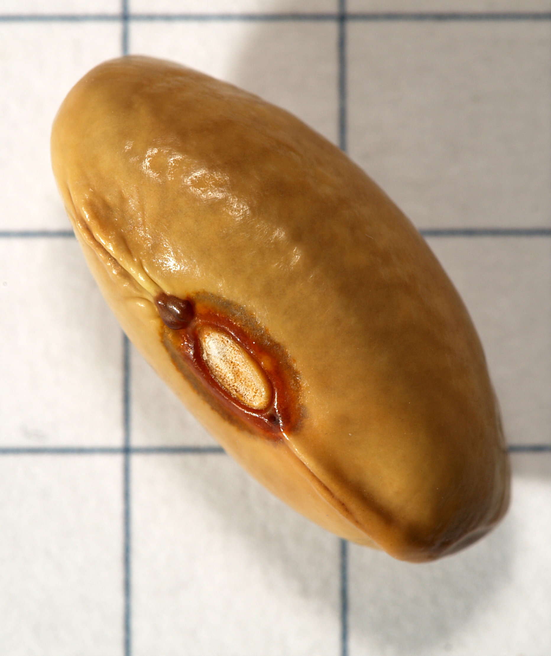 Image of kidney bean