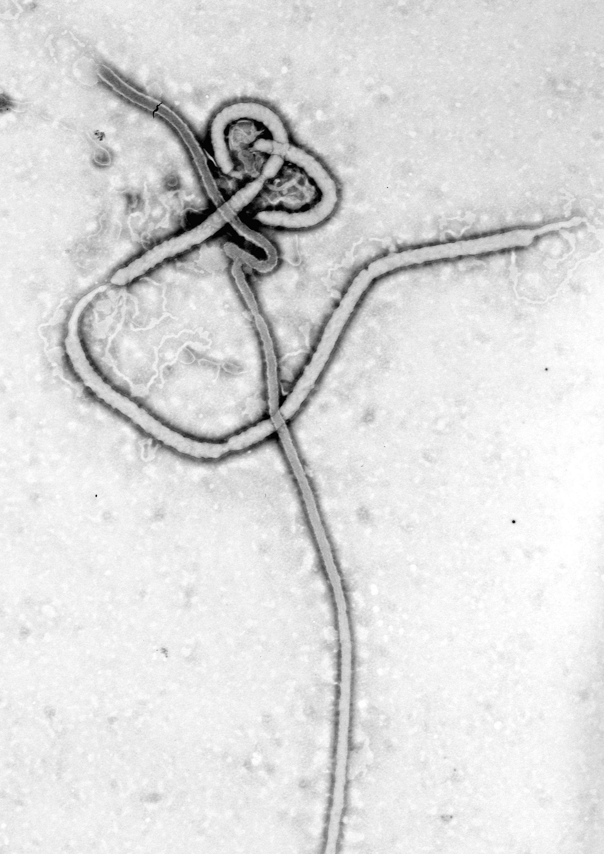 Image of Zaire ebolavirus