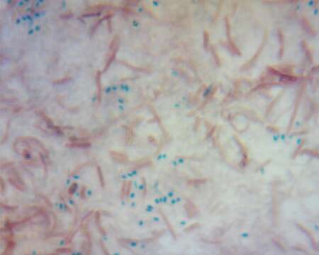 Image de Bacillus cereus