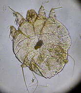 Image of itch mites