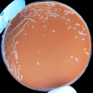 Image of Haemophilus influenzae