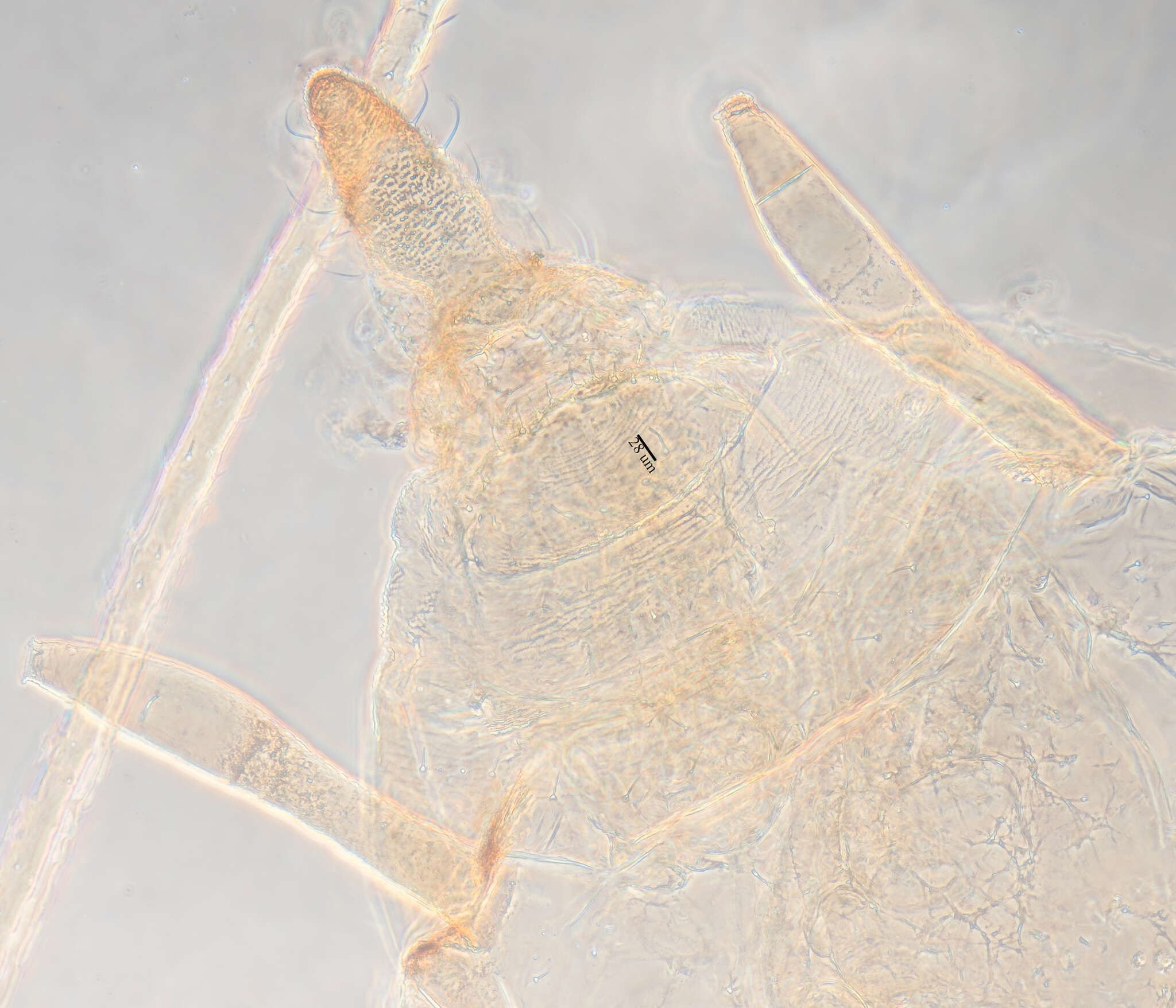 Image of Blackcurrant--Sowthistle Aphid