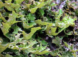 Image of lung lichen