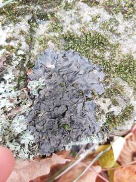 Image of skin lichen