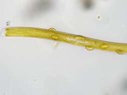 صورة Nitzschia sigmoidea