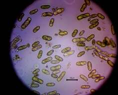 Microcalicium disseminatum (Ach.) Vain. resmi