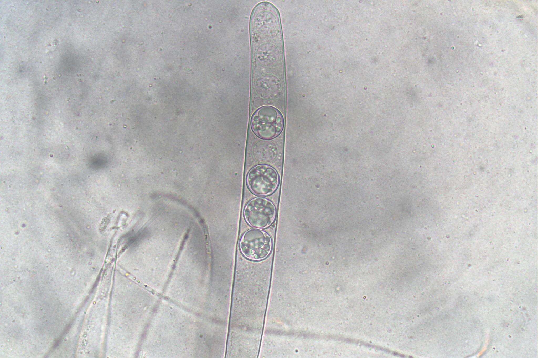 Image of Pulvinula tetraspora (Hansf.) Rifai 1968