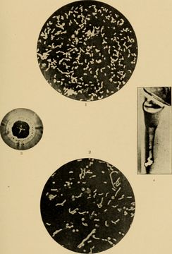 Image of Kommabacillus