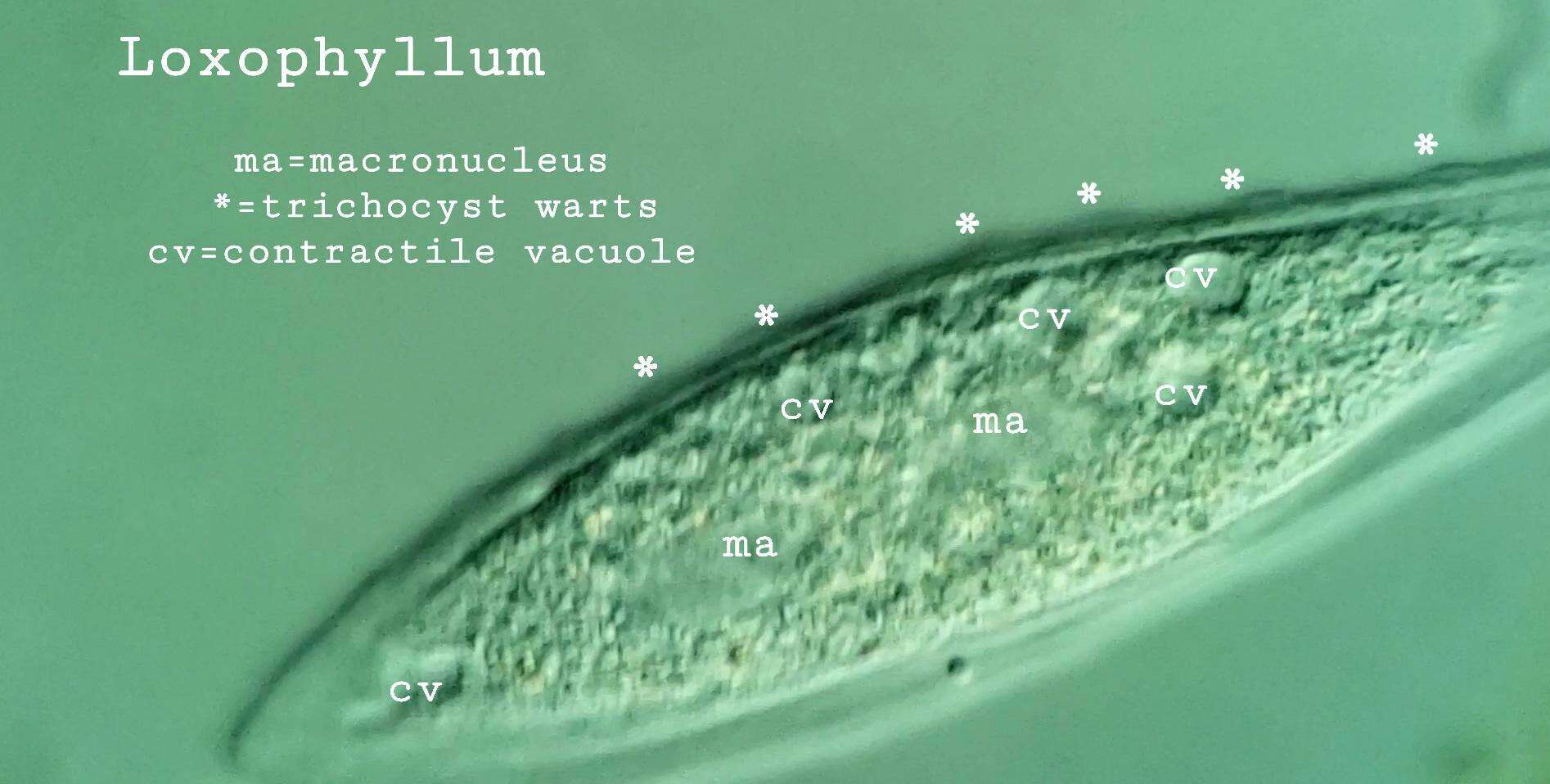 Image of Loxophyllum perihoplophorum