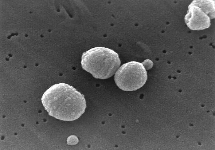 Imagem de Streptococcus pneumoniae